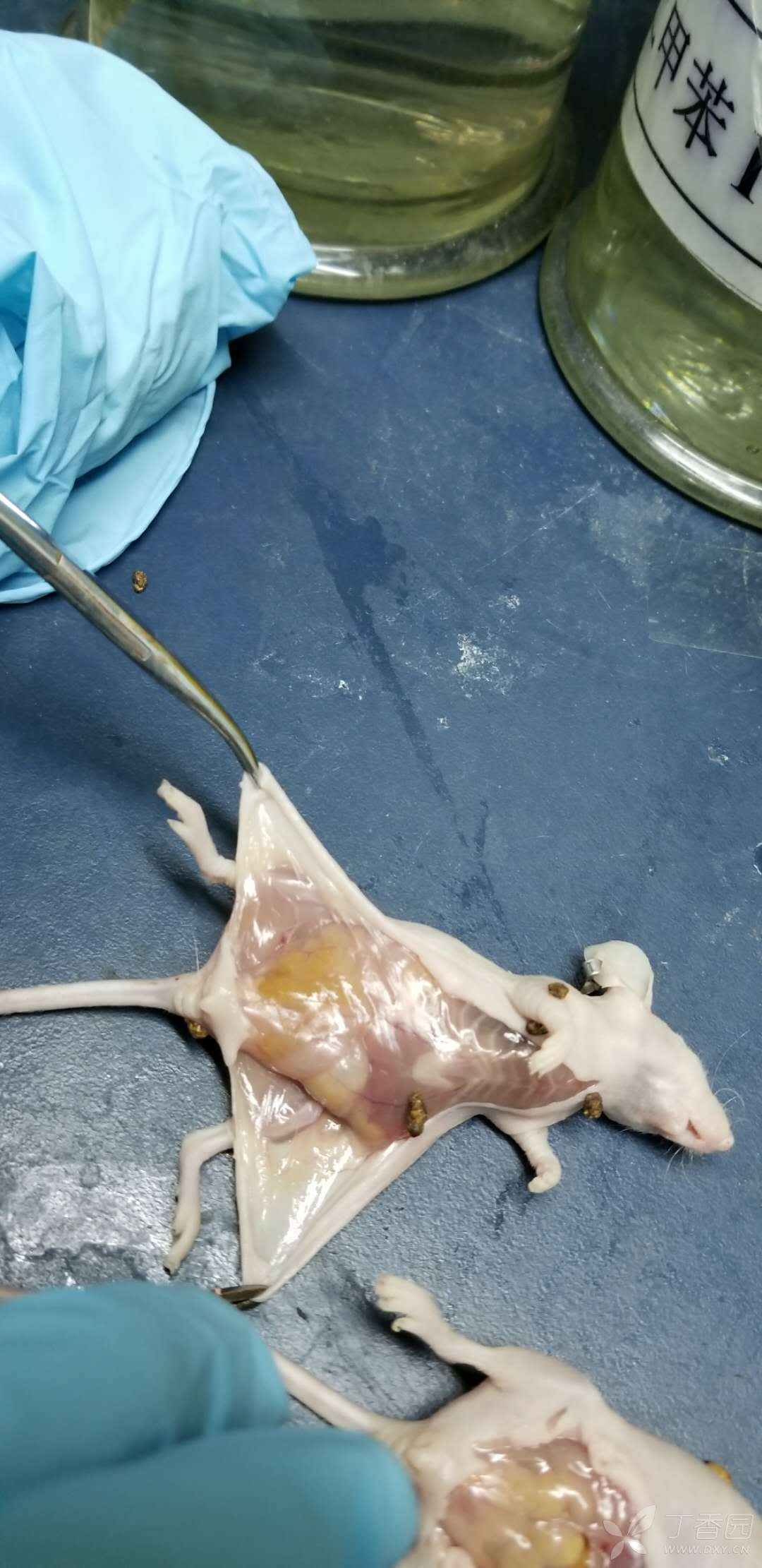 裸鼠乳腺癌,皮下脂肪垫成瘤 - 丁香园论坛