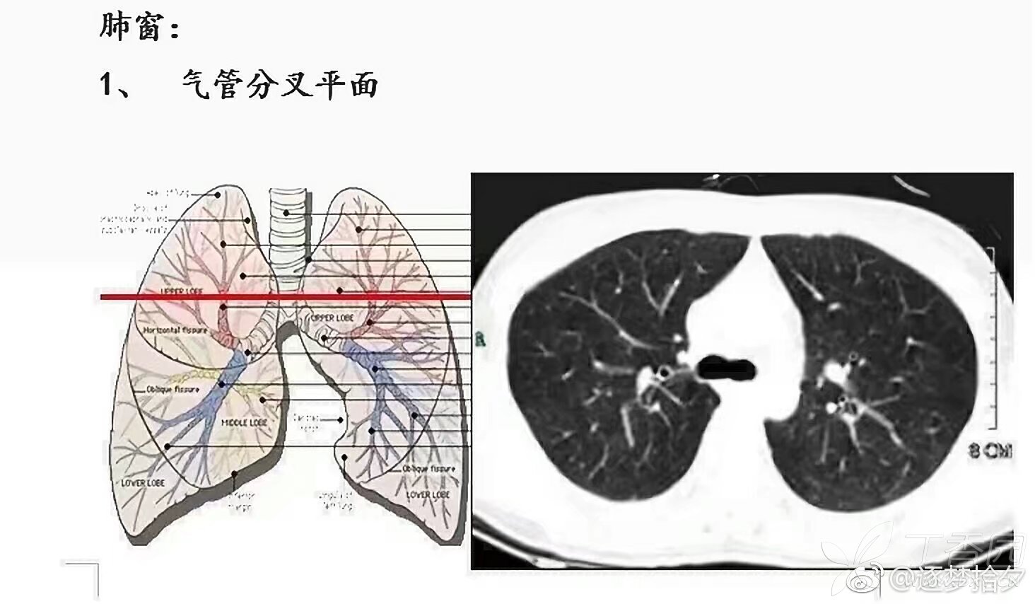 肺叶肺段示意图图片
