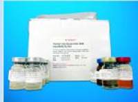 Cytochrome P450 2S1 (CYP2S1) ELISA Kit, Human