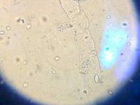 小鼠杂交瘤细胞株；XYCDY-1BV-1E6品牌
