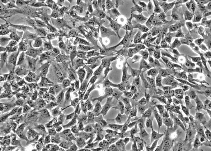 人羊膜间充质基质细胞
