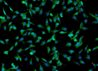 人脐带间充质干细胞