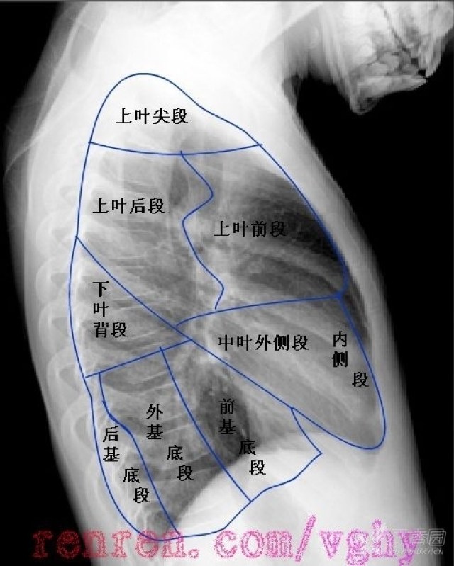 矢状位冠状位示意图图片