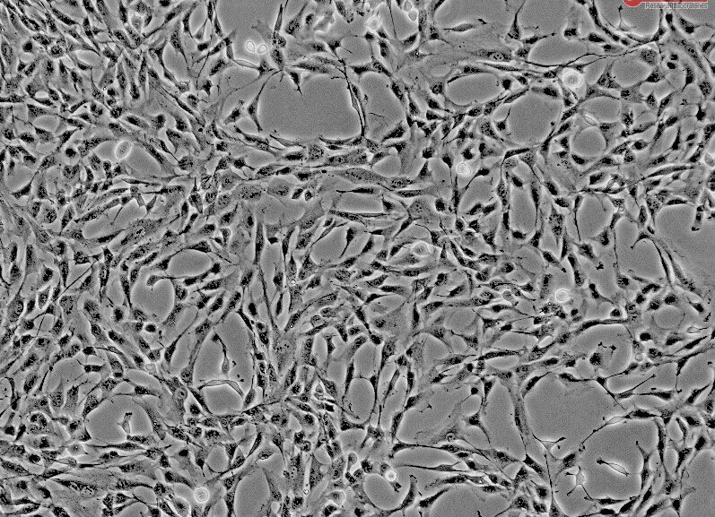 人间充质干细胞--肝脏