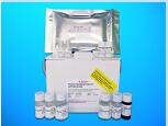 Parathormone 1-34 ELISA Kit (PTH1-34), Human