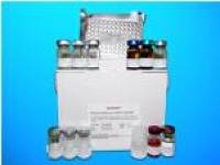 Nucleoside diphosphate kinase B (NME2) ELISA Kit, Human