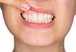 应用需警惕：这 3 类药物可引起牙龈增生