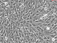 人脊椎间充质干细胞