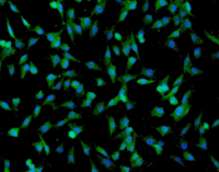 人脐带间充质干细胞