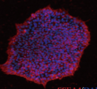多功能干细胞（iPSCs）制备