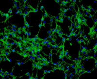 人真皮成纤维细胞--成人