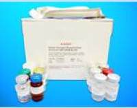Prostatic binding protein ELISA Kit (PBP), Human
