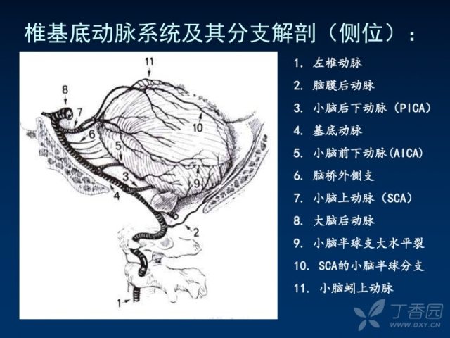 基底动脉分段解剖图图片