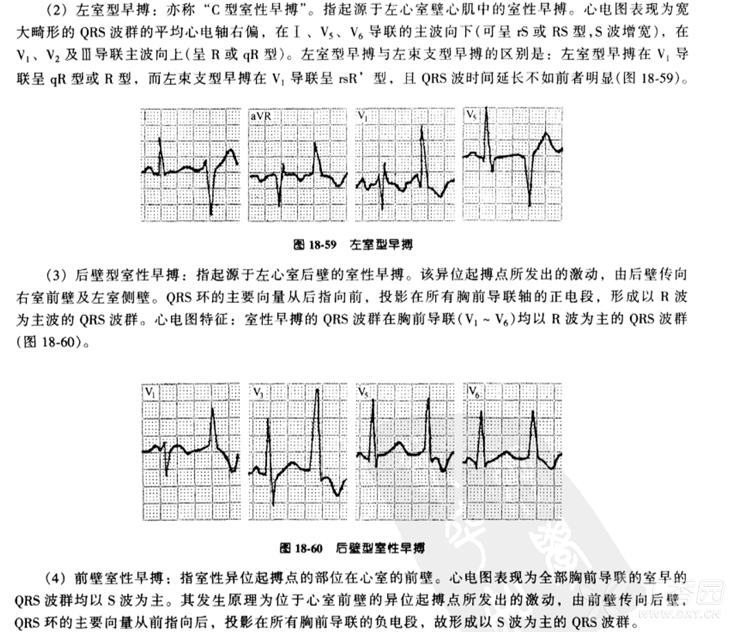 心电图简谱_正常心电图图片