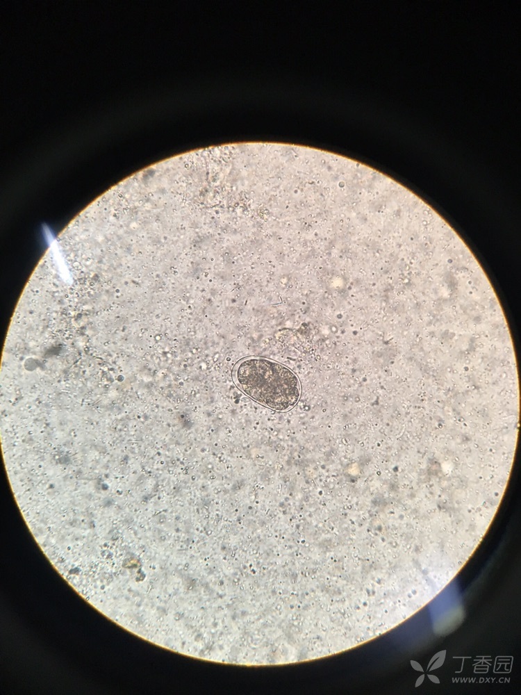 钩虫在显微镜下的图片图片