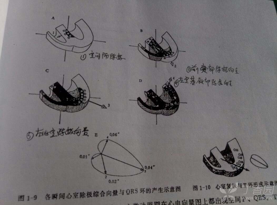 [求助]心电向量环的问题