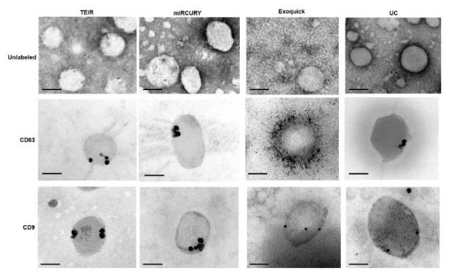 什么是外泌体 3275316371776850520-10.jpg!w640