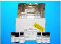 Thymidine Kinase ELISA Kit (TK), Human