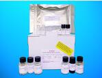 Speckle Type POZ Protein ELISA Kit (SPOP), Human