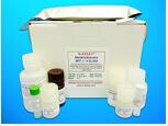 Stromelysin-1 ELISA Kit (ST1), Human