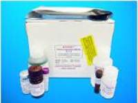 SUMO-conjugating enzyme UBC9 (UBE2I) ELISA Kit, Human