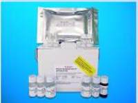 Adenosine Deaminase ELISA Kit (ADA), Human