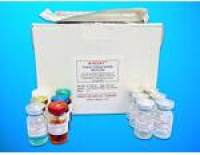Acetyl Coenzyme A Acetyltransferase 2 ELISA Kit (ACAT2), Human