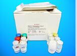 Alkaline Sphingomyelinase ELISA Kit (Alk-Smase), Human