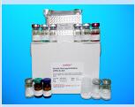 Arylsulfatase F (ARSF) ELISA Kit, Human