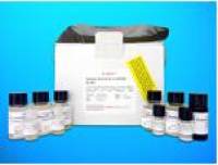 AMP deaminase 2 (AMPD2) ELISA Kit, Human