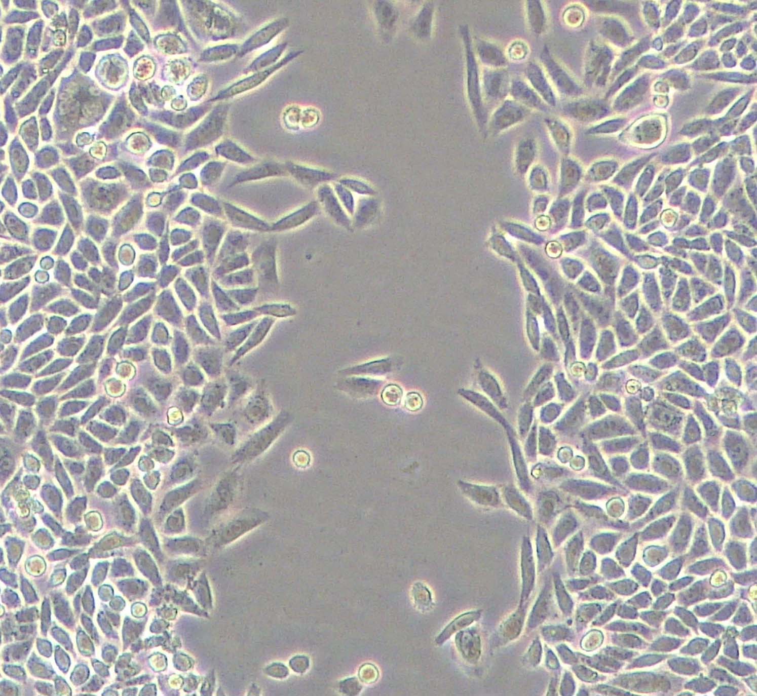 划痕实验检测细胞侵袭、迁移