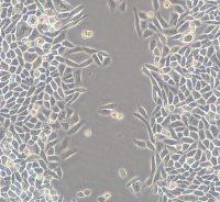 划痕实验检测细胞侵袭、迁移