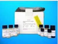 Aspartoacylase-2 (ACY3) ELISA Kit, Human