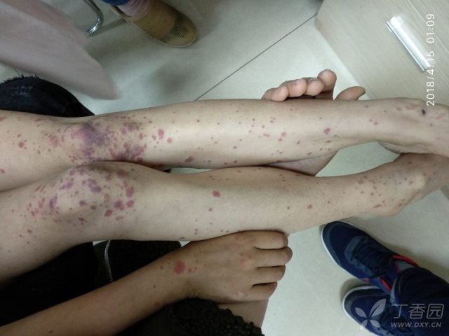 这么疯狂的"海蛇头"?你还遇到过哪些典型到不能再典型的体征?