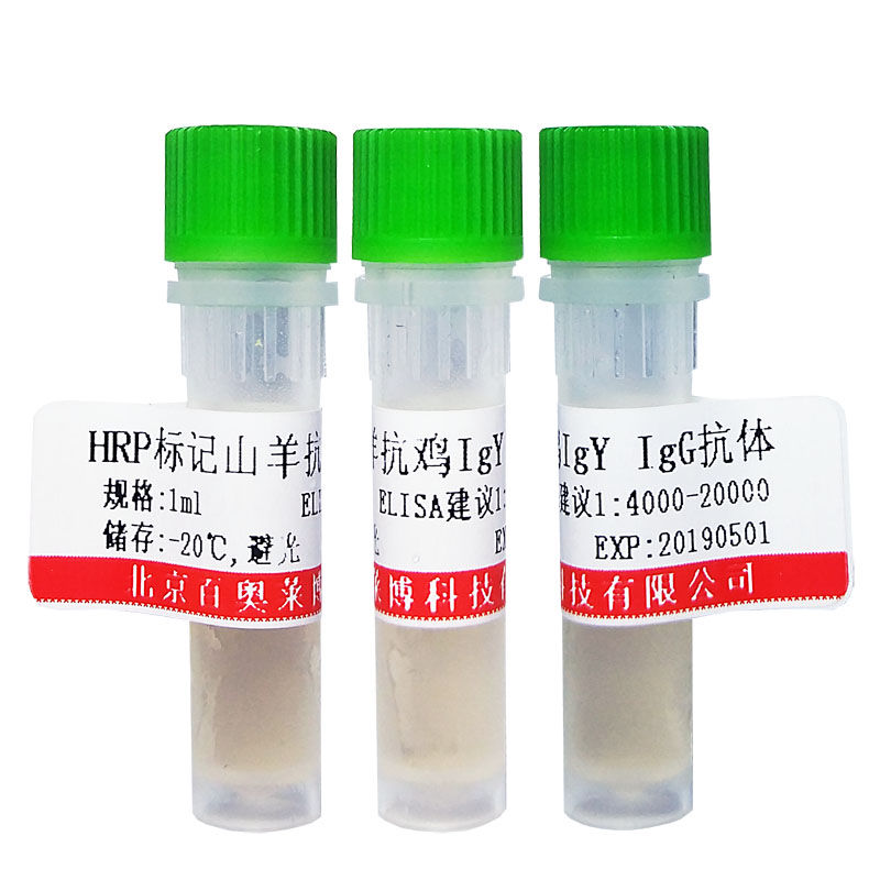 磷酸化BACE1 (Ser498)抗体北京价格