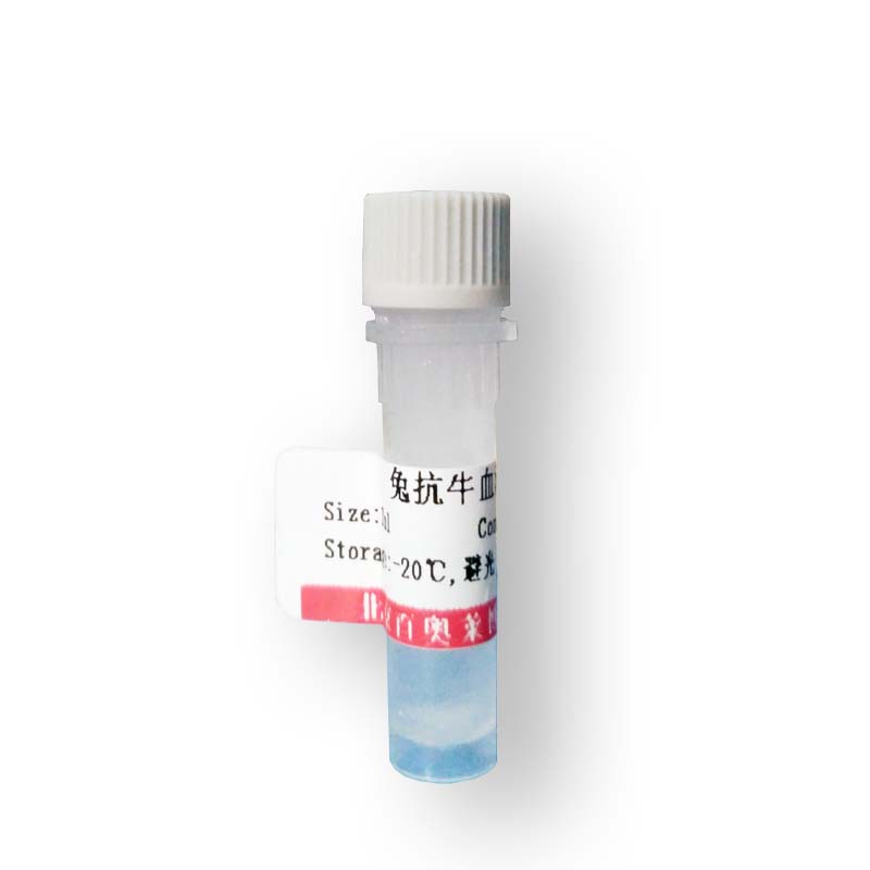磷酸化NFKB p65(Thr435)抗体报价