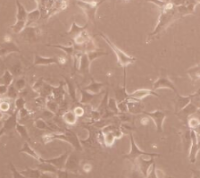 HUVEC ,人脐静脉内皮细胞