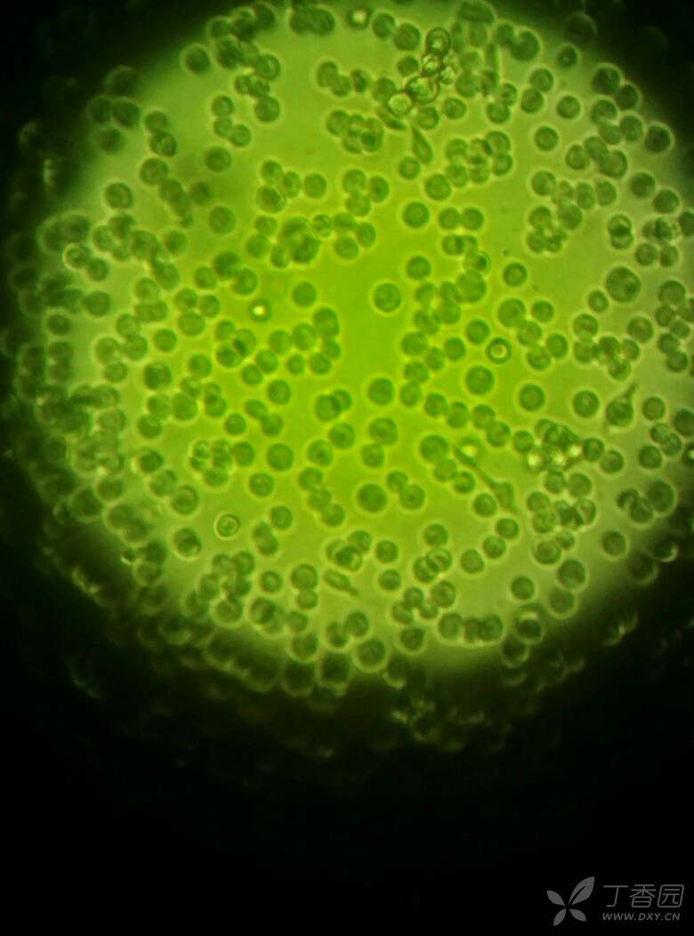 培养的悬浮细胞死亡