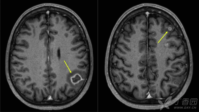 手足看图猜成语_看图猜成语(3)