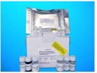 Corin (Atrial Natriuretic Peptide-Converting Enzyme) ELISA Kit, Human