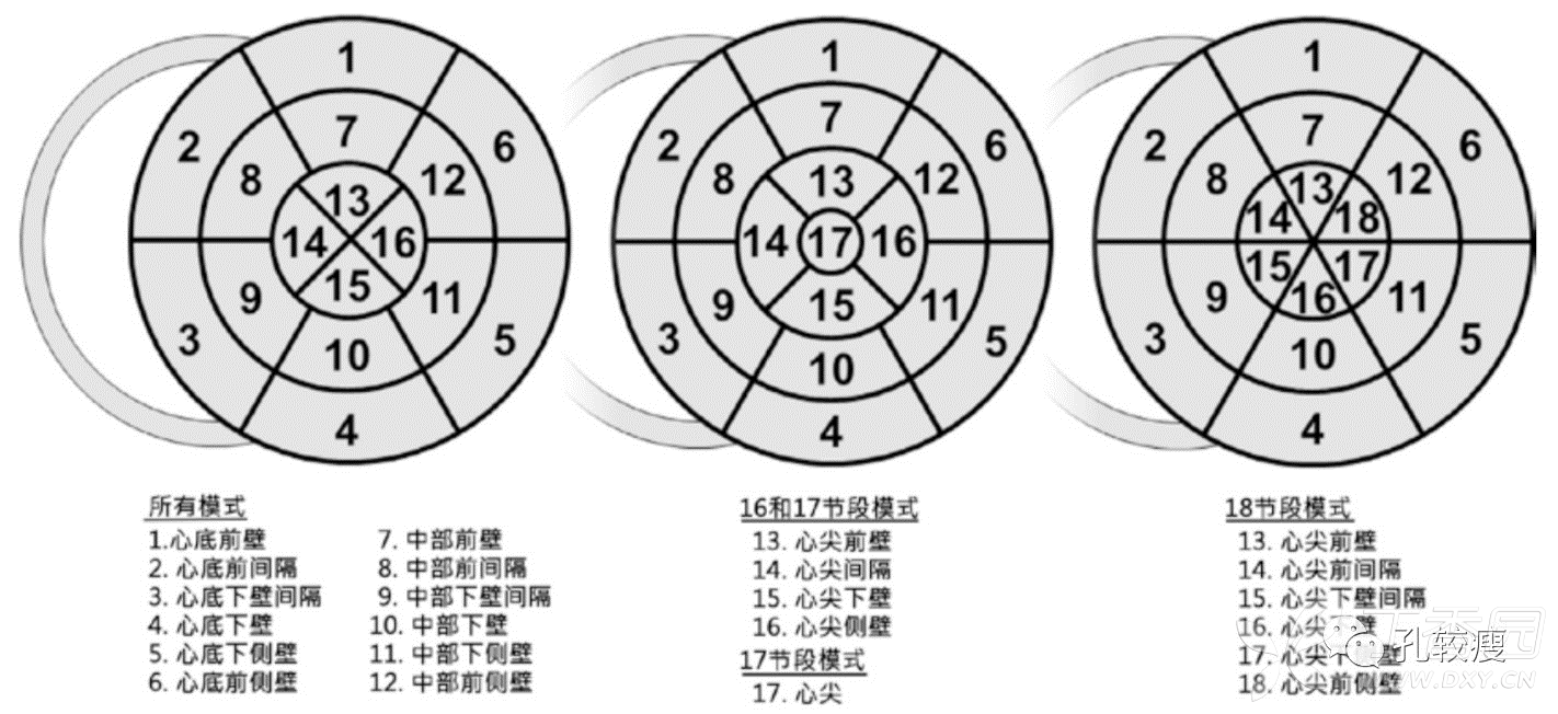 讲座 d1和s1之间闭塞时的心电图表现 三,心室节段是如何划分的?