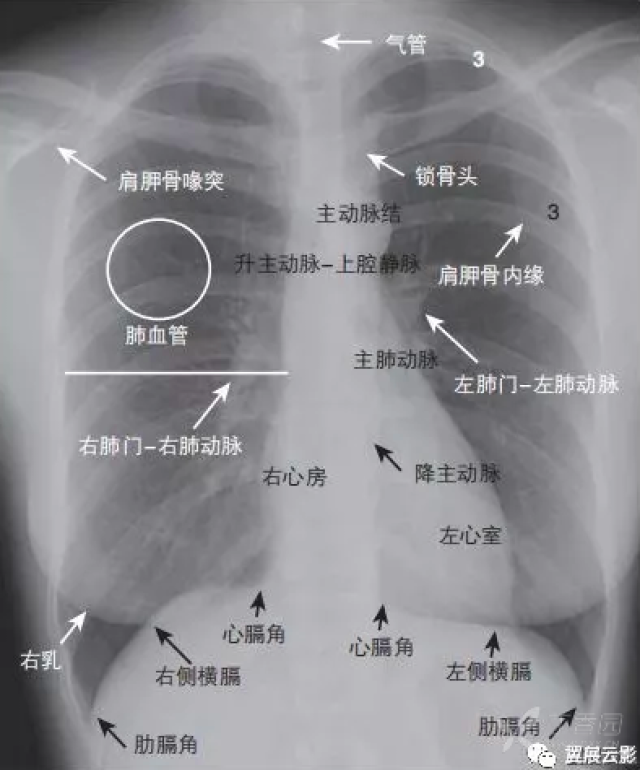 胸片曝光时间图片