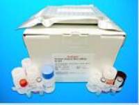 Fatty Acid Synthase ELISA Kit (FAS), Human