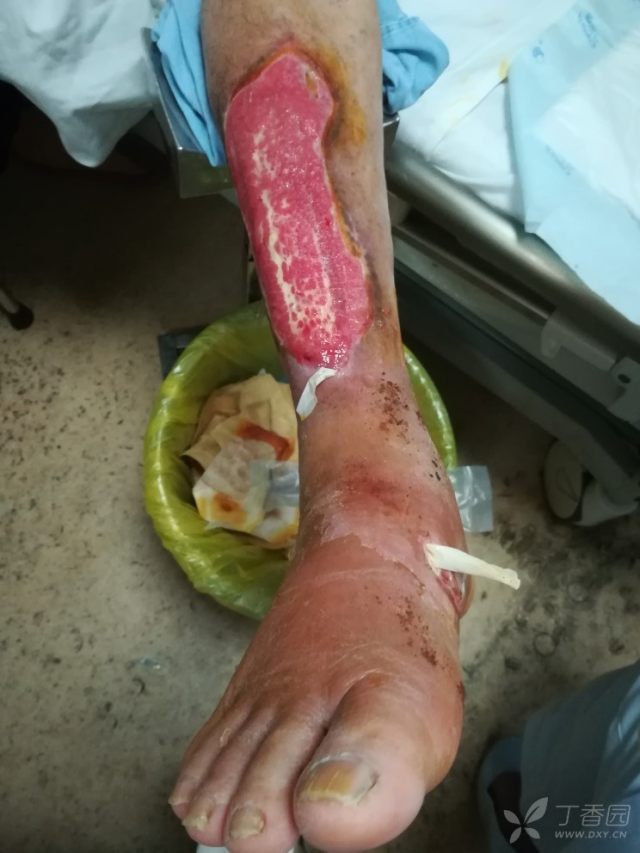 这么疯狂的"海蛇头"?你还遇到过哪些典型到不能再典型的体征?