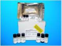 Cytochrome P450 2A7 (CYP2A7) ELISA Kit, Human