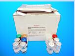 Diamine Oxidase ELISA Kit (DAO), Human