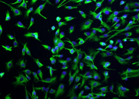HepG2细胞（附STR鉴定报告）