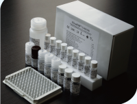 自免糖尿病特异抗体（GADAb ）检测试剂盒（CFDA认证）