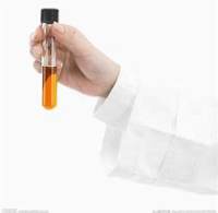 总抗氧化能力（T-AOC）检测