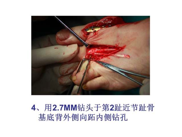 幻灯片15.JPG